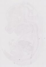 EMAGE:11816