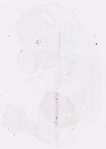 EMAGE:11816