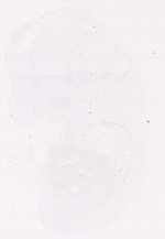 EMAGE:11820