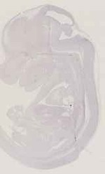 EMAGE:11837