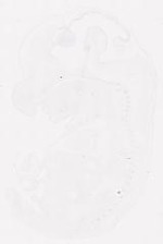 EMAGE:11849