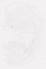 EMAGE:11850