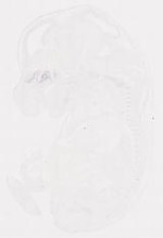 EMAGE:11851