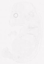 EMAGE:11851