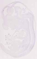 EMAGE:11854