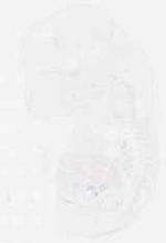 EMAGE:11857