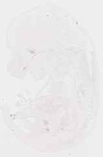 EMAGE:11857