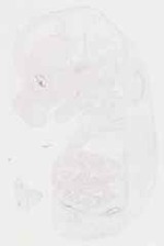 EMAGE:11857
