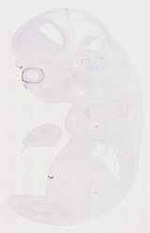 EMAGE:11859