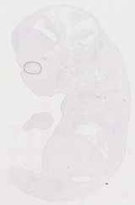 EMAGE:11859
