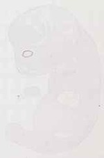 EMAGE:11859