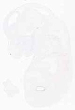 EMAGE:11859