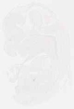 EMAGE:11859