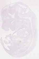 EMAGE:11859