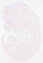EMAGE:11859