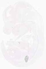 EMAGE:11859