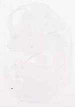 EMAGE:11859