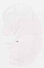 EMAGE:11859
