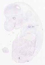 EMAGE:11859