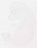 EMAGE:11859