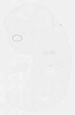 EMAGE:11861