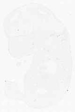 EMAGE:11861