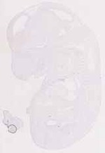 EMAGE:11861