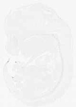 EMAGE:11861