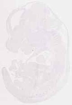EMAGE:11861