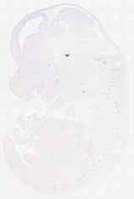 EMAGE:11861