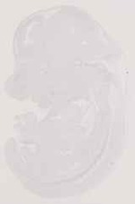 EMAGE:11871