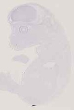 EMAGE:11871