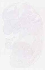 EMAGE:11885