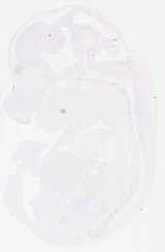 EMAGE:11887