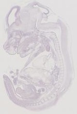 EMAGE:11901