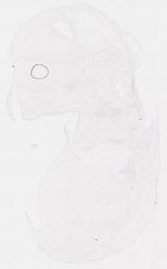 EMAGE:11902