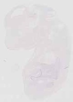 EMAGE:11903