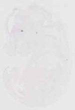 EMAGE:11903