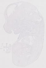 EMAGE:11906