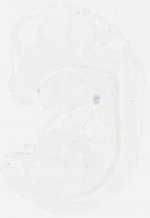EMAGE:11906