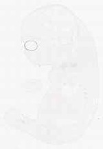 EMAGE:11926