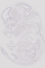 EMAGE:11933