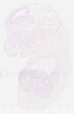 EMAGE:11943