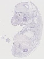 EMAGE:11962