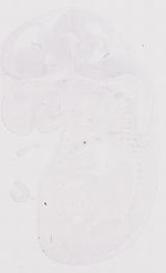 EMAGE:11965