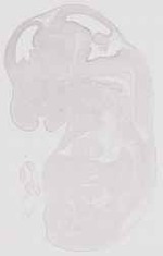 EMAGE:12001