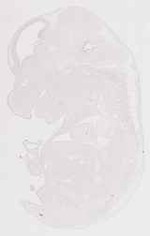 EMAGE:12001