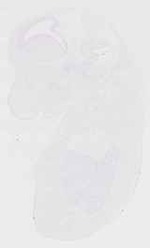EMAGE:12009
