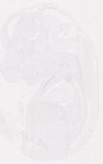 EMAGE:12032