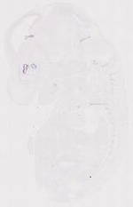 EMAGE:12039